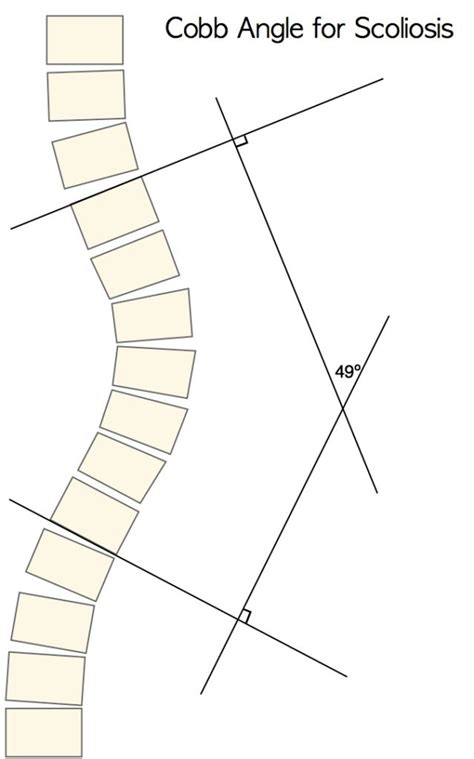 cobb value test method|cobb method.